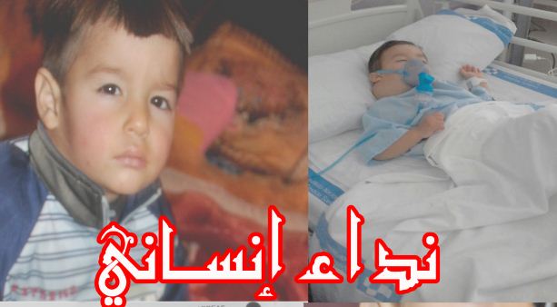 نداء إنساني: الطفل محمد أحميان من الناظور في حاجة للمساعدة لإجراء عملية جراحية لإستئصال ورم في جسده