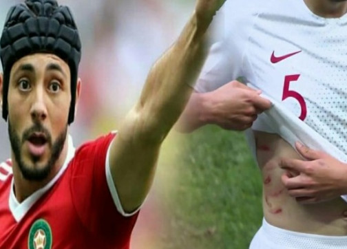 +صور مثيرة: امرابط يترك “بصمته” على لاعب برتغالي والمغاربة يحيونه
