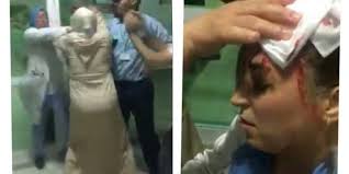 غريب: شجار عنيف بين ممرضتين في مصحة خاصة بالناظور ينتهي في مخافر الشرطة