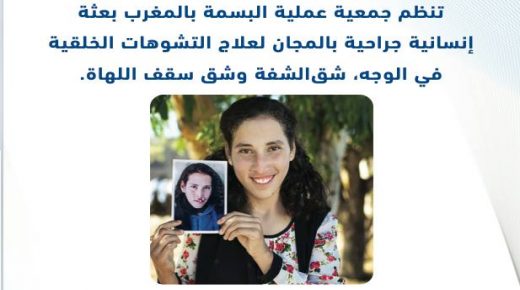 اعلان:جمعية “بسمة المغرب” تطلق حملة بجهة الشرق لتقويم تشوهات خلقية في الوجه