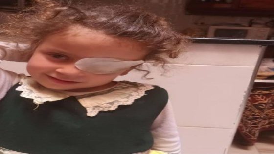 حالة انسانية +صورة : طفلة من جماعة صاكا تحتاج لزرع قرنية عين بسبب المرض