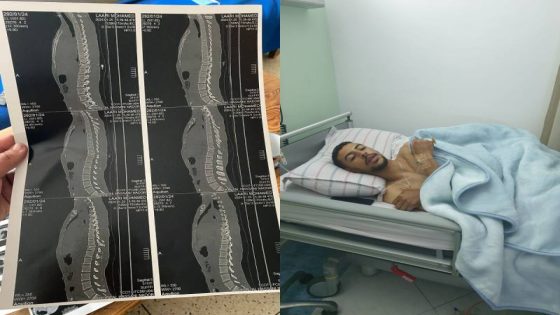 نداء إنساني: الشاب محمد بحاجة لدعمكم بعد حادث مؤلم تسبب له بكسر بالعمود الفقري